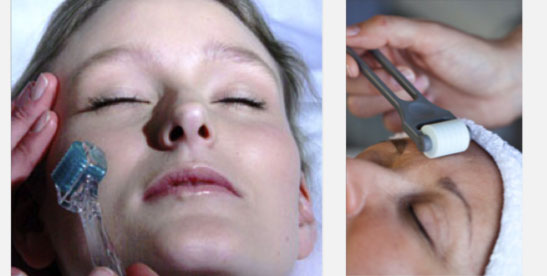 Dermal Micro Needling